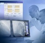 Siemens: Neue Software für eine gleichbleibende Bildqualität medizinischer Displays